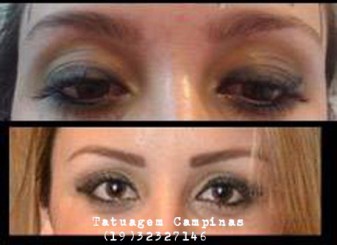 micropigmentação